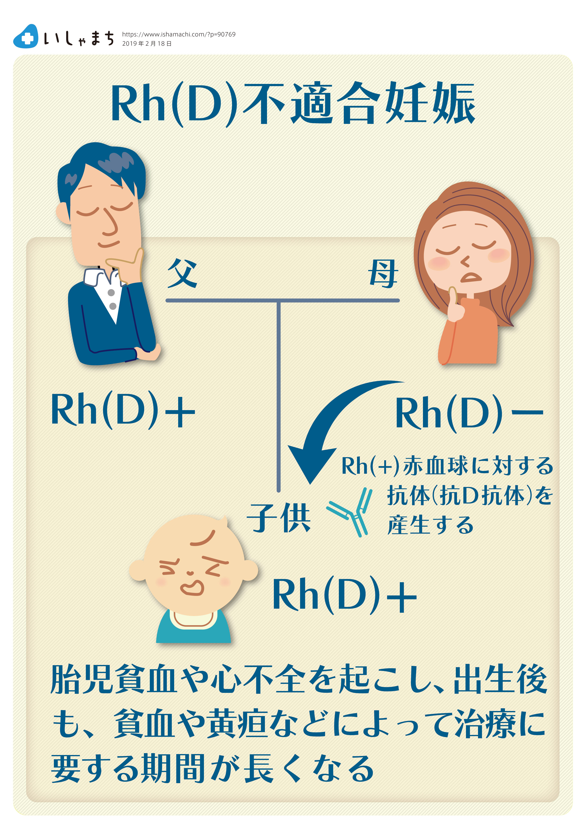 Rh（D）不適合妊娠