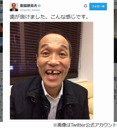 東国原英夫氏の前歯が抜けた 講演中に差し歯取れ 会場大爆笑