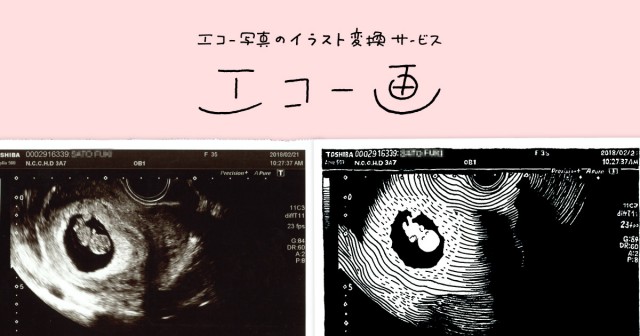 産婦人科 診察 エコー検査 10423000500 の写真素材 イラスト素材