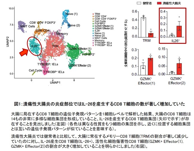 潰瘍性大腸炎の新たな病態メカニズムを解明 ニコニコニュース